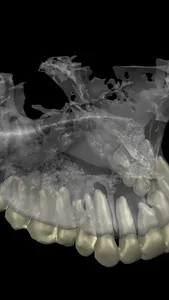 Dental CT View screenshot 9