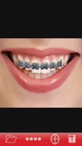 Orthodontic screenshot 0