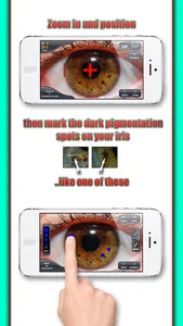 Health Test - The iridology app screenshot 2