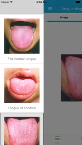 Tongue diagnosis handbook screenshot 0