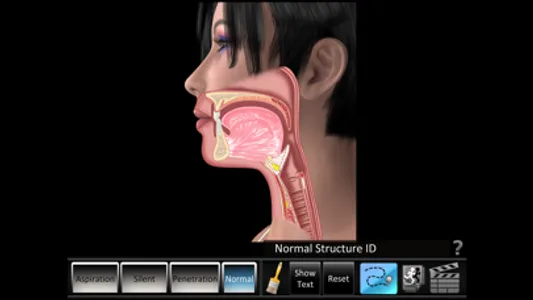 Aspiration Disorders screenshot 0