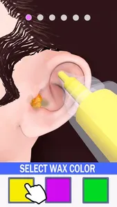 Earwax Removal screenshot 0