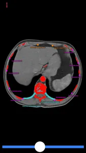 Biopsy Guide screenshot 1