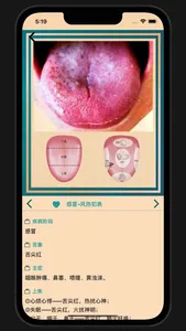 中医舌诊宝典 screenshot 2