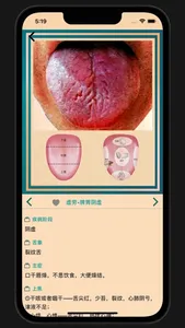 中医舌诊宝典 screenshot 4