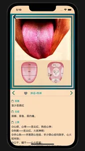 中医舌诊宝典 screenshot 5