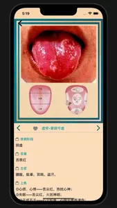 中医舌诊宝典 screenshot 6