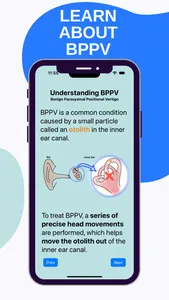 Epley Assist: Dizziness Relief screenshot 3