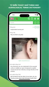Từ điển Thuật ngữ Thính học screenshot 5