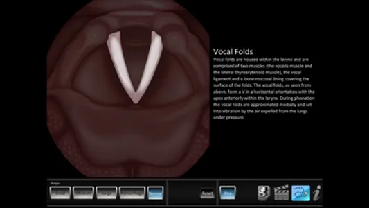 Vocal Pathology: Polyps screenshot 3