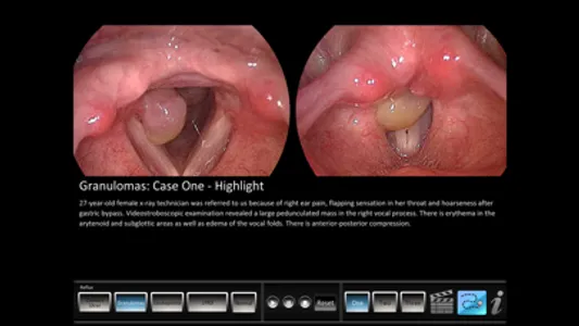 Vocal Pathology: Reflux screenshot 0