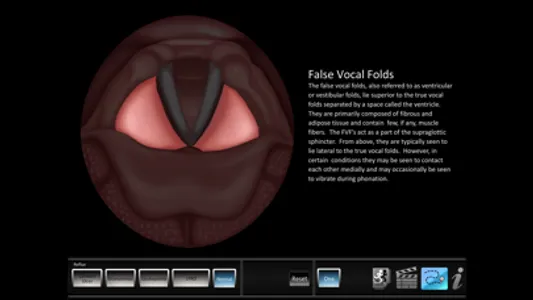 Vocal Pathology: Reflux screenshot 1