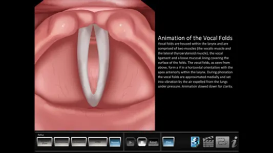 Vocal Pathology: Reflux screenshot 2