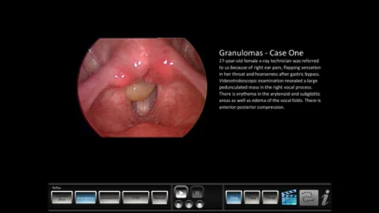 Vocal Pathology: Reflux screenshot 3