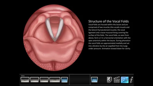 Vocal Pathology: Reflux screenshot 4