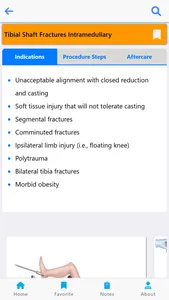 Orthopedic Surgery Techniques screenshot 5