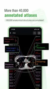 Imaging Anatomy Atlas screenshot 1