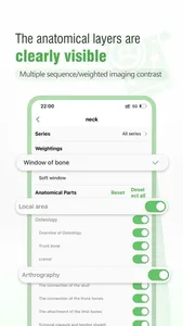 Imaging Anatomy Atlas screenshot 4