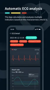 Heart Beat & Rate: Aion ECG screenshot 1