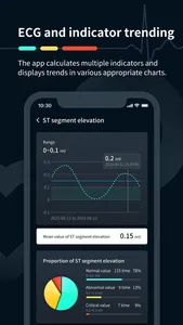 Heart Beat & Rate: Aion ECG screenshot 2