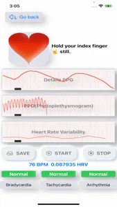 Cardiac Diagnosis screenshot 3