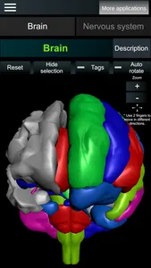 Brain and nerves (Anatomy) screenshot 0