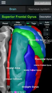 Brain and nerves (Anatomy) screenshot 4