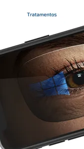 Mult Lentes screenshot 3