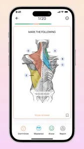 Neuroflip NEET PG flashcards screenshot 2