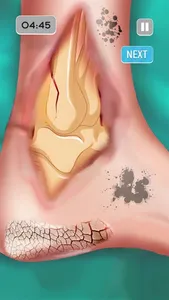 ASMR Foot Care: Doctor Games screenshot 0