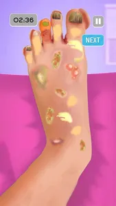 ASMR Foot Care: Doctor Games screenshot 2