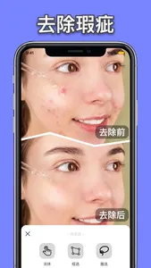 无痕消除笔-照片杂物去除,橡皮擦&图片编辑 screenshot 4