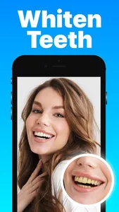 Teeth Whitener & Whitening screenshot 0