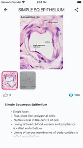 HistoGrams⁺ screenshot 3
