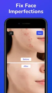 AI Eraser - Object Remover screenshot 5