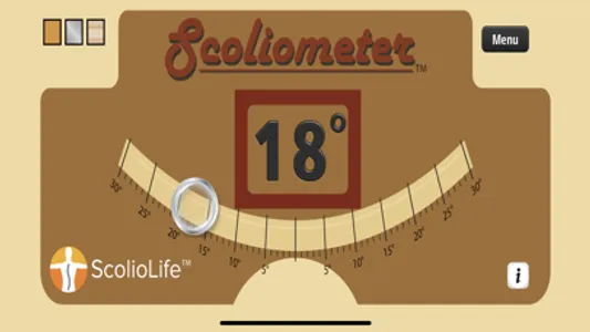 Scoliometer screenshot 2