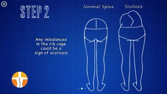Scoliometer screenshot 4