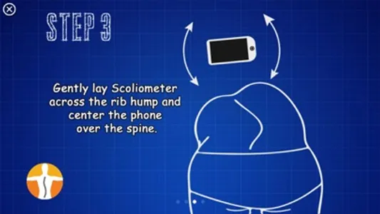 Scoliometer screenshot 5