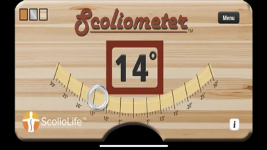 Scoliometer screenshot 8