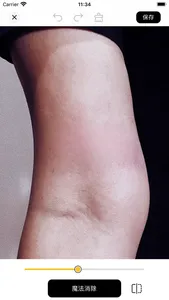 Bear Eraser - AI Remove Object screenshot 3