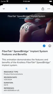 Arthrex Rep screenshot 1