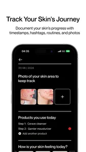 Skin Diary: Track & Glow screenshot 1