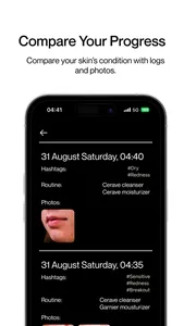 Skin Diary: Track & Glow screenshot 2