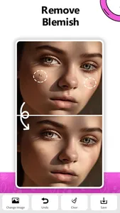Remove Object - AI Erase Photo screenshot 3