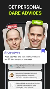 Hairify – AI Hair Scan & Care screenshot 3