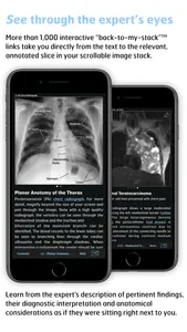 Radiology - Thoracic Imaging screenshot 3