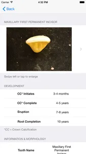 Tooth Morphology - Your Quick Reference Guide screenshot 1