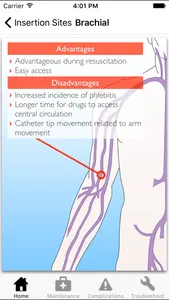 Catheter Pro screenshot 1