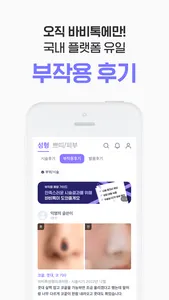 바비톡 - 1등 성형/시술 정보앱 screenshot 5