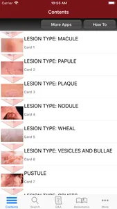 Fitzpatrick's Derm Flash Cards screenshot 1